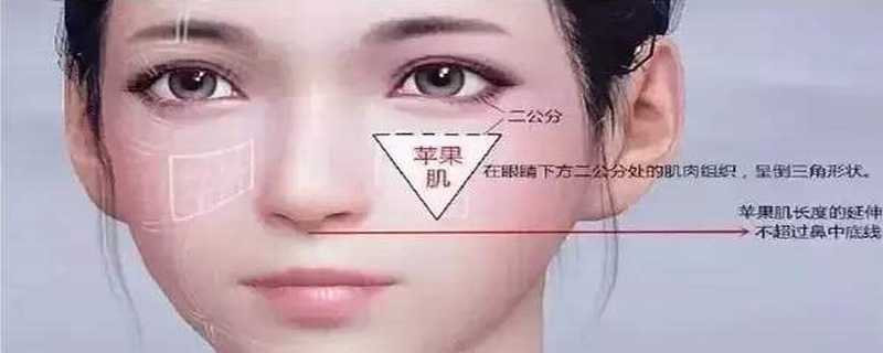 苹果肌下垂导致的法令纹怎么办
