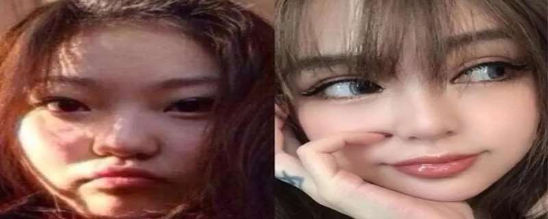 周扬青整容前后,周扬青的家世怎么样 周扬青整容前后,周扬青的家世怎么样